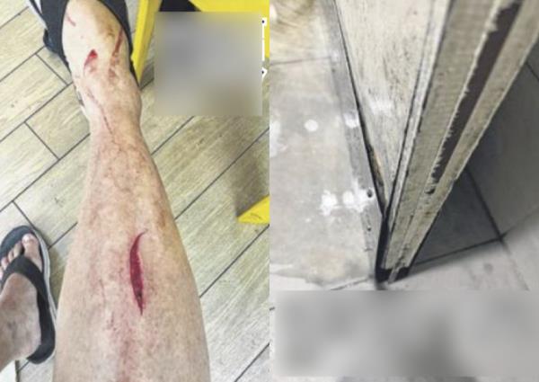 Man ends up with 10 stitches after suffering nasty gash at Punggol coffee shop toilet